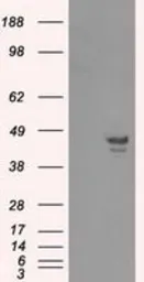 Anti-CaMKI delta antibody [2C6] used in Western Blot (WB). GTX84738