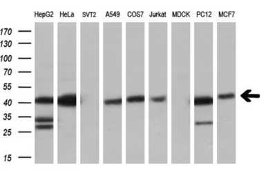 Anti-C9orf41 antibody [6E4] used in Western Blot (WB). GTX84740