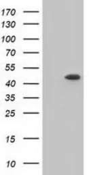 Anti-C9orf41 antibody [6E4] used in Western Blot (WB). GTX84740