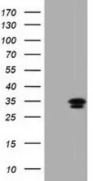 Anti-C21orf59 antibody [2B2] used in Western Blot (WB). GTX84745