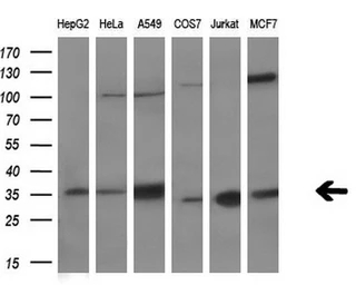 Anti-C21orf59 antibody [2H5] used in Western Blot (WB). GTX84746