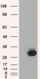 Anti-C21orf59 antibody [2H5] used in Western Blot (WB). GTX84746