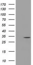 Anti-C21orf59 antibody [1A1] used in Western Blot (WB). GTX84747