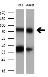 Anti-C17orf28 antibody [5C4] used in Western Blot (WB). GTX84754