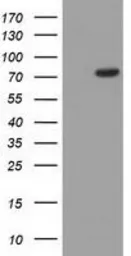 Anti-C17orf28 antibody [5C4] used in Western Blot (WB). GTX84754