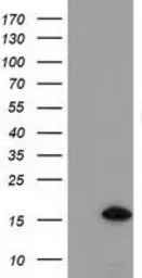 Anti-C15orf40 antibody [1D8] used in Western Blot (WB). GTX84759