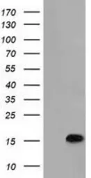 Anti-C15orf40 antibody [1D9] used in Western Blot (WB). GTX84760