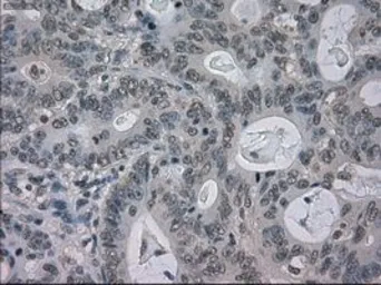 Anti-BUB1B antibody [11D7] used in IHC (Paraffin sections) (IHC-P). GTX84767