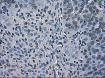 Anti-BUB1B antibody [11D7] used in IHC (Paraffin sections) (IHC-P). GTX84767