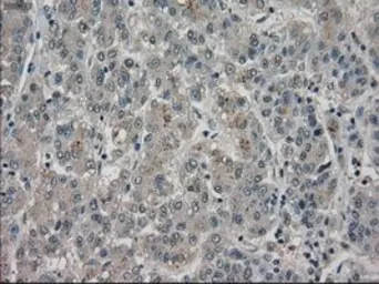 Anti-BUB1B antibody [11D7] used in IHC (Paraffin sections) (IHC-P). GTX84767