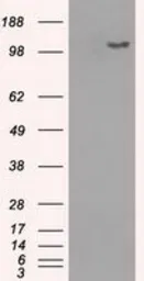 Anti-BUB1B antibody [11D7] used in Western Blot (WB). GTX84767