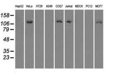 Anti-BUB1B antibody [11D7] used in Western Blot (WB). GTX84767