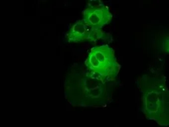 Anti-BTK antibody [3A2] used in Immunocytochemistry/ Immunofluorescence (ICC/IF). GTX84789