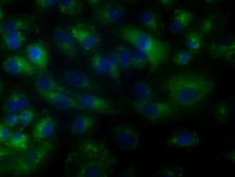 Anti-BTK antibody [3A2] used in Immunocytochemistry/ Immunofluorescence (ICC/IF). GTX84789