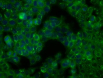 Anti-BTK antibody [3A2] used in Immunocytochemistry/ Immunofluorescence (ICC/IF). GTX84789