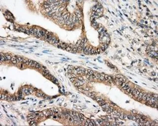 Anti-BTK antibody [3A2] used in IHC (Paraffin sections) (IHC-P). GTX84789