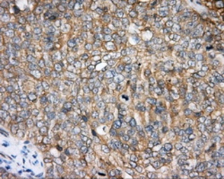 Anti-BTK antibody [3A2] used in IHC (Paraffin sections) (IHC-P). GTX84789