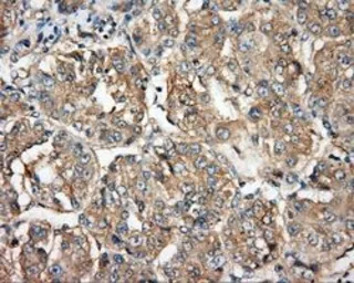 Anti-BTK antibody [3A2] used in IHC (Paraffin sections) (IHC-P). GTX84789