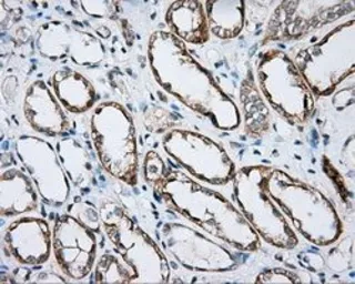 Anti-BTK antibody [3A2] used in IHC (Paraffin sections) (IHC-P). GTX84789