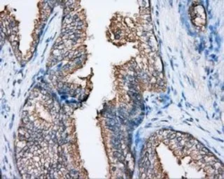 Anti-BTK antibody [3A2] used in IHC (Paraffin sections) (IHC-P). GTX84789