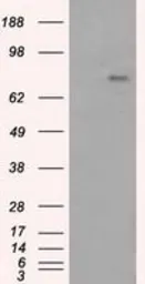 Anti-BTK antibody [3A2] used in Western Blot (WB). GTX84789