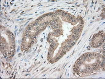 Anti-CD147 antibody [5D8] used in IHC (Paraffin sections) (IHC-P). GTX84795