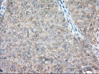 Anti-CD147 antibody [5D8] used in IHC (Paraffin sections) (IHC-P). GTX84795