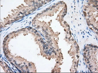 Anti-CD147 antibody [5D8] used in IHC (Paraffin sections) (IHC-P). GTX84795