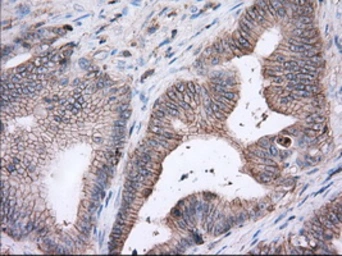 Anti-CD147 antibody [4D3] used in IHC (Paraffin sections) (IHC-P). GTX84799