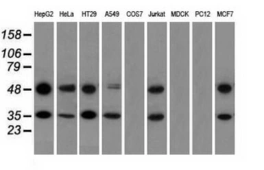 Anti-CD147 antibody [4D3] used in Western Blot (WB). GTX84799
