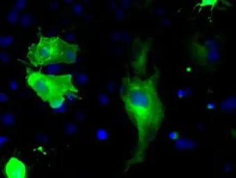 Anti-B-Raf antibody [1D2] used in Immunocytochemistry/ Immunofluorescence (ICC/IF). GTX84807