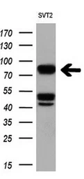 Anti-B-Raf antibody [1D2] used in Western Blot (WB). GTX84807