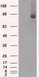 Anti-B-Raf antibody [1D2] used in Western Blot (WB). GTX84807
