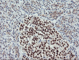 Anti-Bcl-XL antibody [4A9] used in IHC (Paraffin sections) (IHC-P). GTX84834