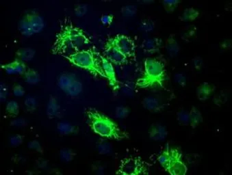 Anti-BCKDK antibody [11C9] used in Immunocytochemistry/ Immunofluorescence (ICC/IF). GTX84836