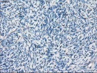 Anti-BCKDK antibody [11C9] used in IHC (Paraffin sections) (IHC-P). GTX84836