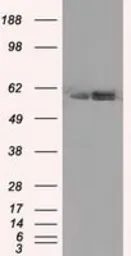 Anti-ATP5B antibody [1B10] used in Western Blot (WB). GTX84845