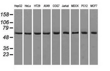 Anti-ATP5B antibody [1B10] used in Western Blot (WB). GTX84845