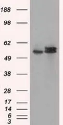 Anti-ATP5B antibody [6C4] used in Western Blot (WB). GTX84848