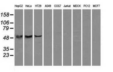 Anti-ATP5B antibody [6C4] used in Western Blot (WB). GTX84848