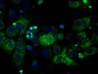 Anti-ATP5B antibody [4E5] used in Immunocytochemistry/ Immunofluorescence (ICC/IF). GTX84849