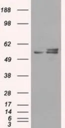 Anti-ATP5B antibody [4E5] used in Western Blot (WB). GTX84849