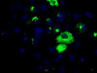 Anti-APP antibody [4C3] used in Immunocytochemistry/ Immunofluorescence (ICC/IF). GTX84873