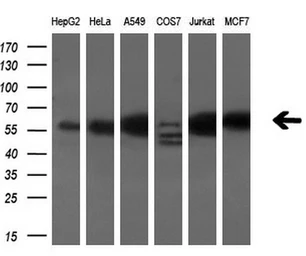 Anti-Annexin XI antibody [1C6] used in Western Blot (WB). GTX84884