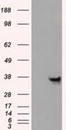 Anti-Annexin A10 antibody [4D8] used in Western Blot (WB). GTX84885