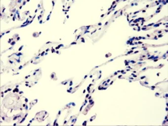 Anti-AKT3 antibody [9B2] used in IHC (Paraffin sections) (IHC-P). GTX84906