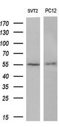 Anti-AKT3 antibody [9B2] used in Western Blot (WB). GTX84906