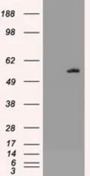 Anti-AKT3 antibody [9B2] used in Western Blot (WB). GTX84906