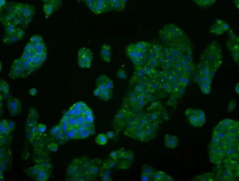Anti-AKT2 antibody [4H7] used in Immunocytochemistry/ Immunofluorescence (ICC/IF). GTX84908