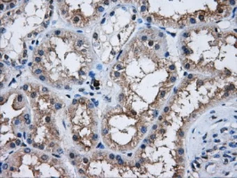 Anti-AKT2 antibody [4H7] used in IHC (Paraffin sections) (IHC-P). GTX84908